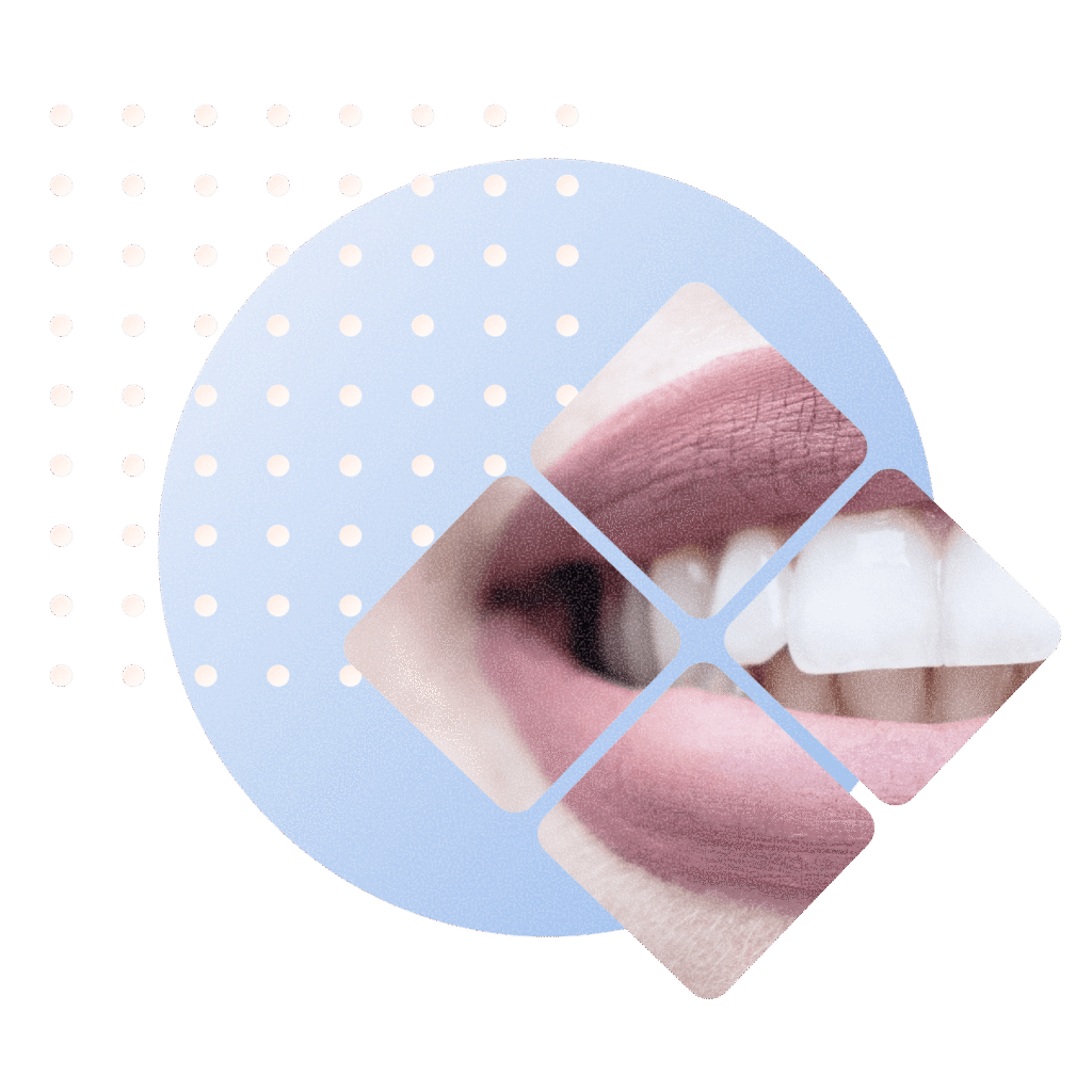 Metamorfozy uśmiechu Dentallo