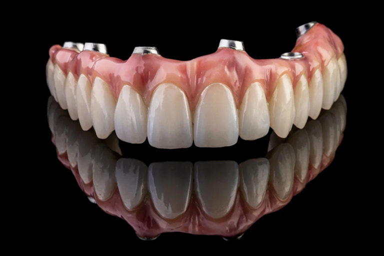 Jak dbać o implant i koronę, żeby służyły całe życie