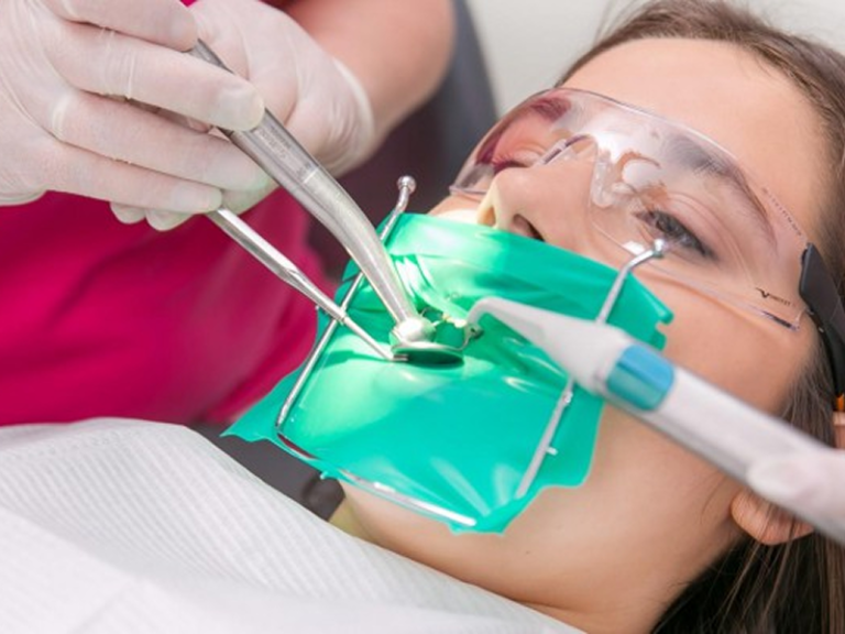 Leczenie kanałowe zęba w koferdamie podczas zabiegu endodontycznego w gabinecie stomatologicznym