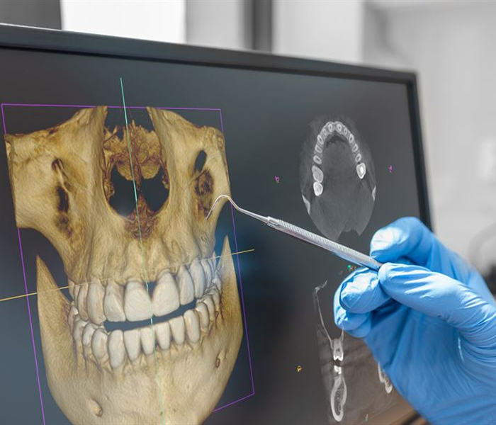 Tomografia komputerowa CBCT przed leczeniem kanałowym zębów w gabinecie stomatologicznym